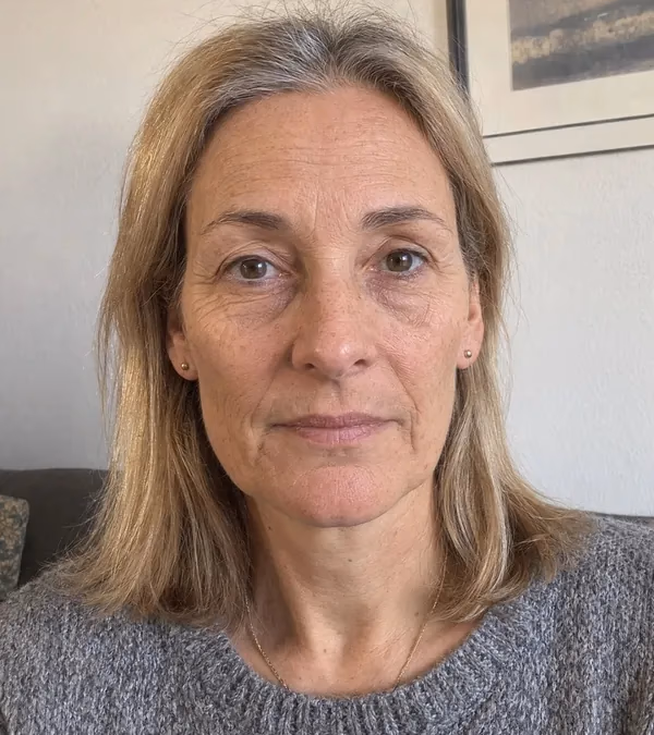 Vorher – Renate